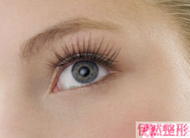 微创翘睫法双眼皮价格范围是多少钱