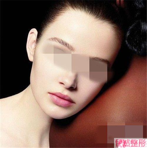 唇裂在哪个介绍调节整形果较明X？