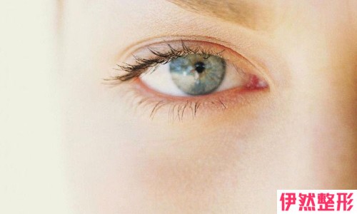埋线法打造双眼皮的不适应症状
