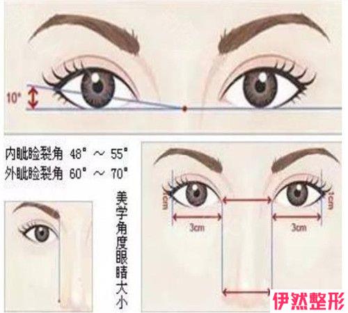 单眼皮的肿泡眼可做韩式微创翘睫双眼皮吗