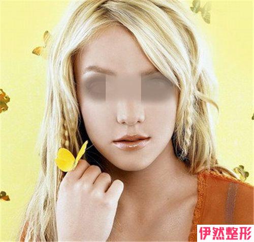 吸脂消除双下巴的价格大概是多少
