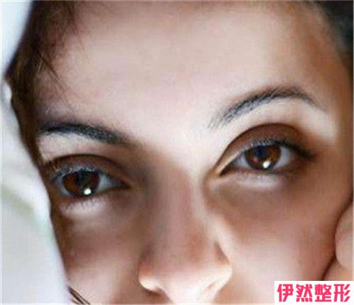 较常见的整形手术并发症是什么