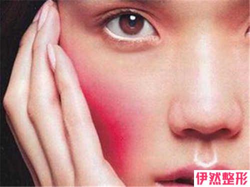 光子去红血丝价格和什么条件相关