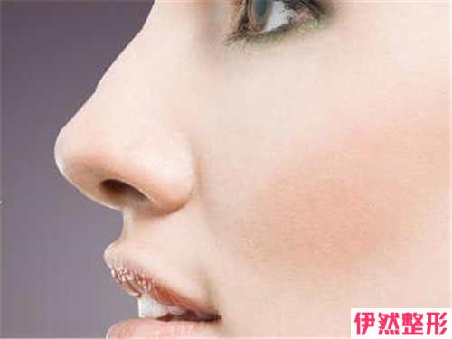 上下两段式鼻部整形手术是不是可以科技含量高的刻画我们的鼻子