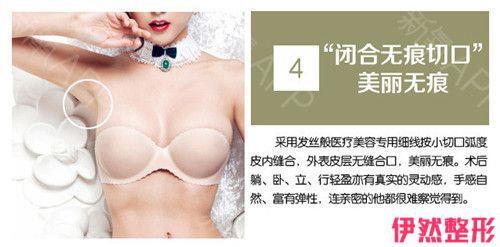胸下垂矫正何时能正常运动