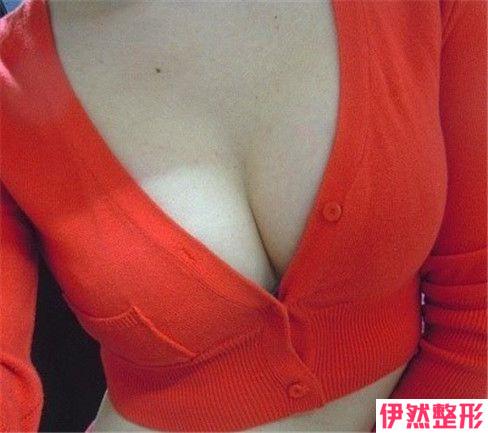 乳房下垂矫正护理时期都有哪些注意事项