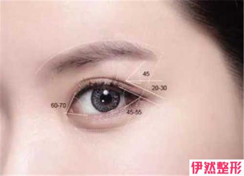 韩式定型双眼皮的费用受那些因素的影响