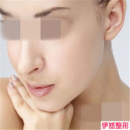 大v线面部提升安不没问题果好不好