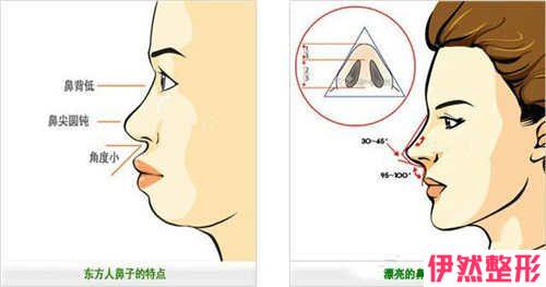 misk04d隆鼻手术的女性有哪些