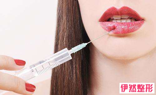 上海胶原蛋白注射丰唇