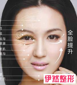 脸部脂肪填充大约多少钱啊