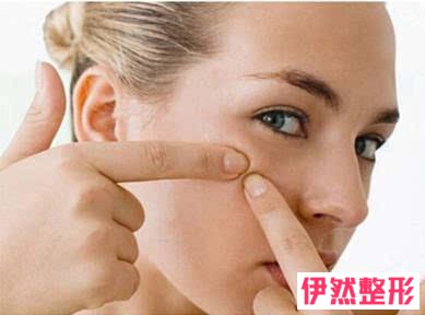 痘痘挤完后怎么处理