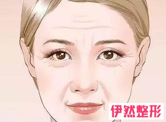 去除抬头纹大约需要多少钱