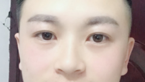 开内眼角能用力睁眼吗?开内眼角要每天扒吗?