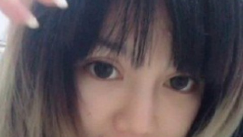 开内眼角能维持多久?开内眼角是长期的吗?