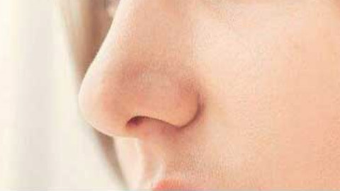 玻尿酸隆鼻会肿胀吗?玻尿酸隆鼻会肿多久?