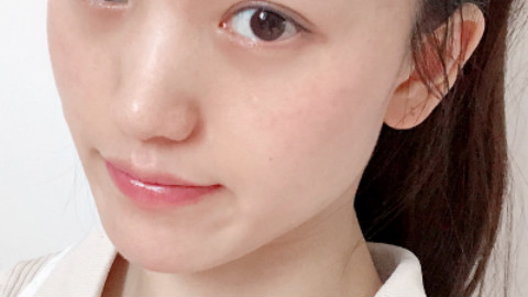 埋线提升恢复原样吗?埋线提升需要恢复多久?