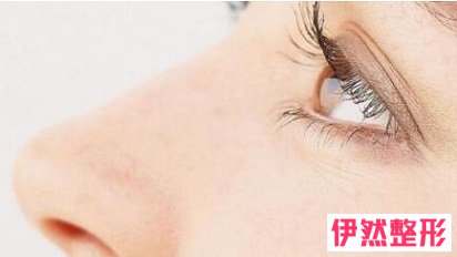 胶原蛋白注射隆鼻果自然吗?胶原蛋白注射隆鼻大概需要多少钱?