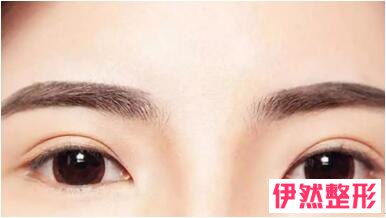 点状纹眉几天恢复?点状纹眉恢复后是什么样