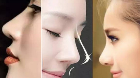 鼻部手术要拆线吗?一般几天拆线?鼻部手术什么时候拆线好?