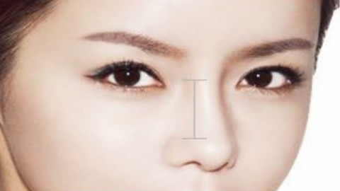 鼻部手术要拆线吗?一般几天拆线?鼻部手术什么时候拆线好?
