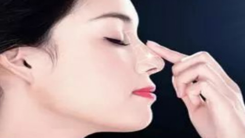 重庆当代王旭明医生做鼻子怎么样?鼻修复案例,鼻子不歪了!