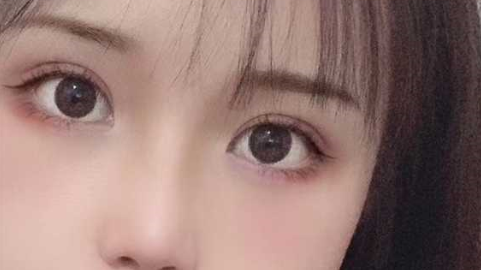 双眼皮埋线要拆线吗?双眼皮埋线用拆线吗?