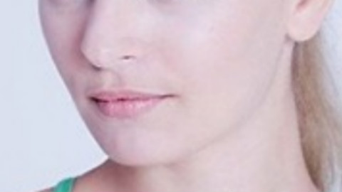 歪鼻矫正有几种方法?歪鼻矫正有必要吗?