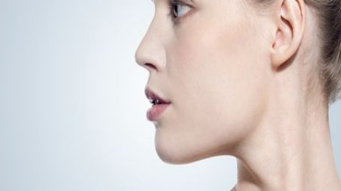 朝天鼻矫正一个月可以恢复吗?朝天鼻矫正价格和材质有关吗?