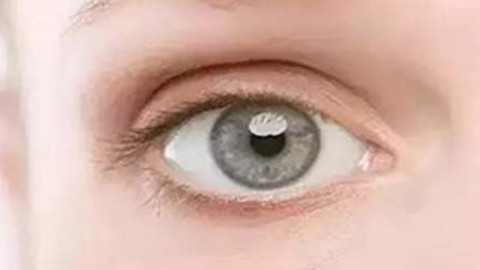 眼睛功能受损可以双眼皮修复吗?双眼皮线较短能修复吗?
