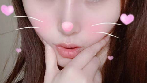 鼻部手术整形稳定性怎么样?鼻部手术整形看着自然吗