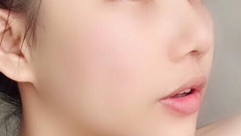 鼻部手术整形稳定性怎么样?鼻部手术整形看着自然吗