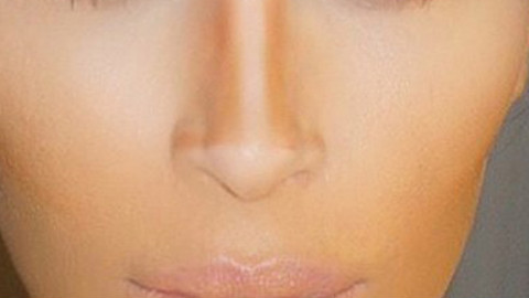 硅胶假体隆鼻适合哪些鼻型?硅胶假体隆鼻适合人群?