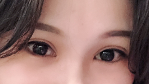 成都美莱医院双眼皮哪个医生做得好?医生案例＋内部价格表