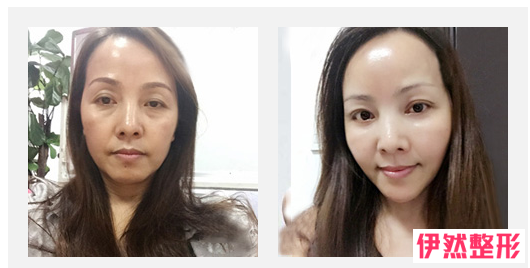 1353528706 1353528706